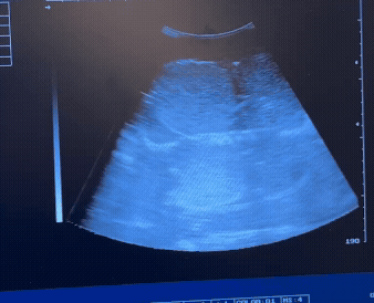 Ultrasound Image